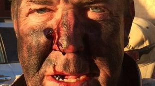Jeremy Clarkson publica una imagen suya sucio y ensangrentado